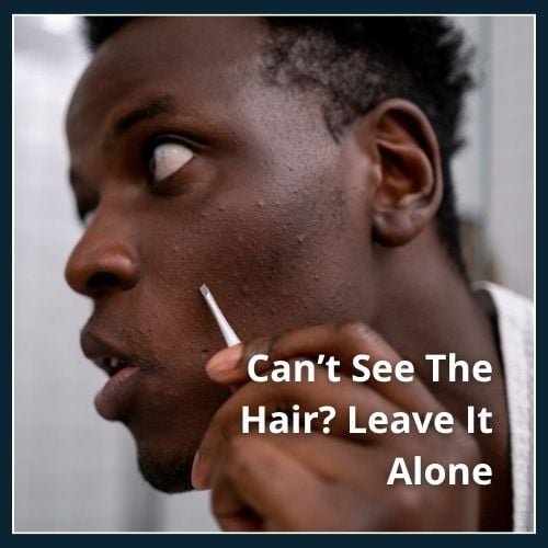 man holding tweezers inspecting ingrown hairs on his face